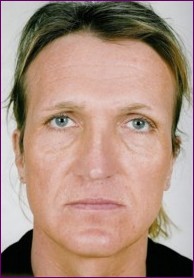 Before facial feminisation